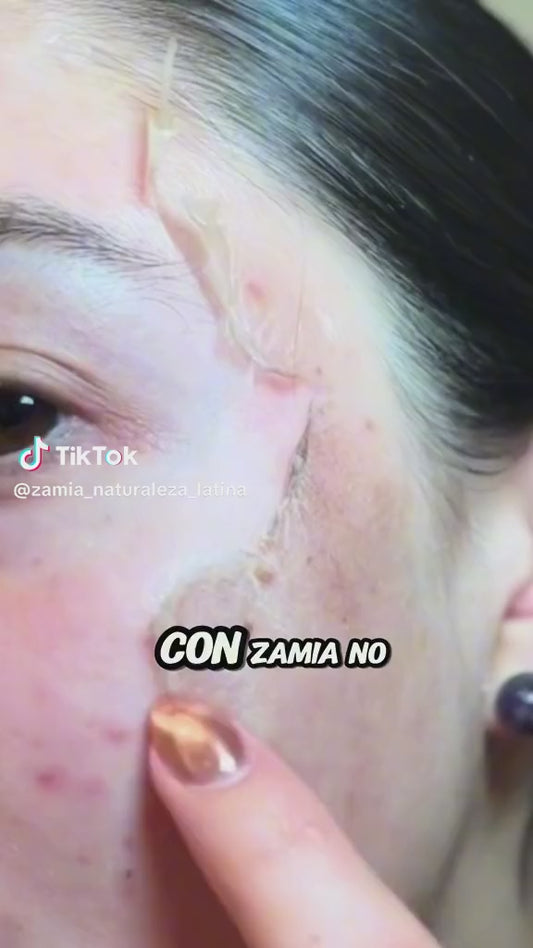 Recupera la Confianza que Vive en Tu Piel: Crema despigmentante y aclarante Zamia